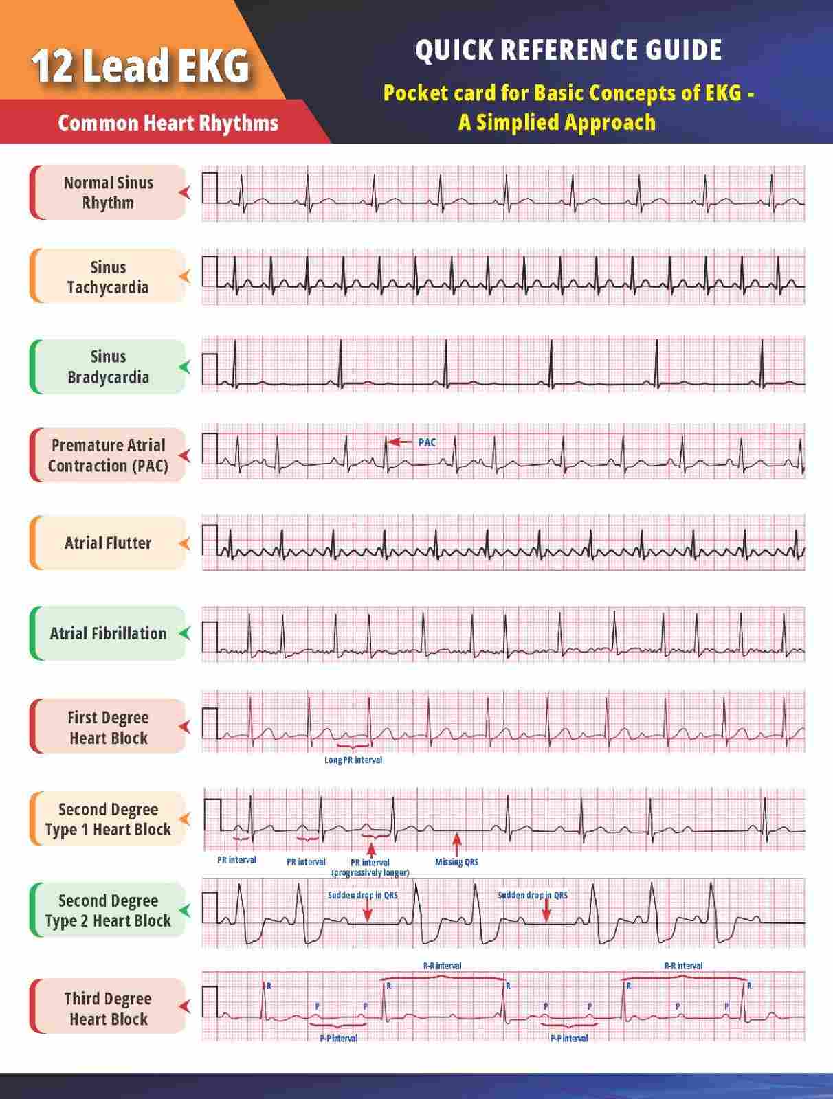 12 Lead EKG Pocket Card