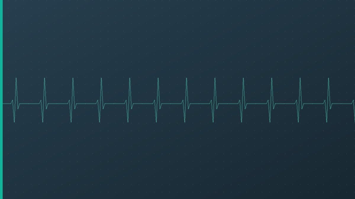 Pacemakers & ICDs: Essentials for Bedside Nurses